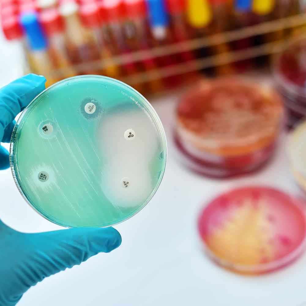 Antimicrobial resistance
