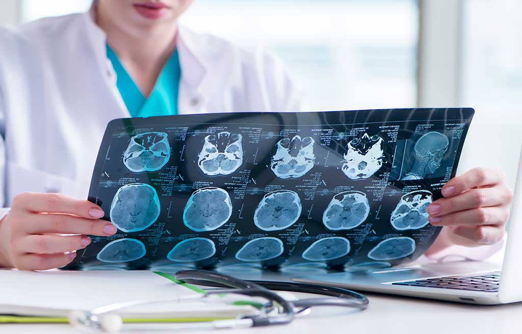 MRI